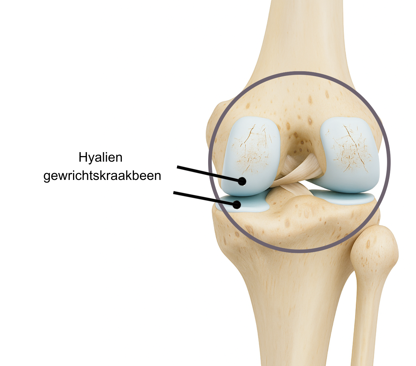 Knie artrose hyalien kraakbee